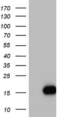 ZNF307 (ZKSCAN4) antibody