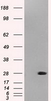 ZNF317 Antibody