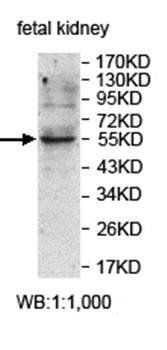 ZNF320 antibody