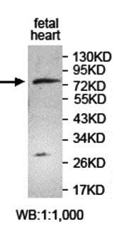 ZNF33A antibody
