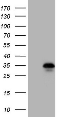 ZNF34 antibody