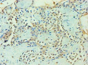 ZNF346 antibody