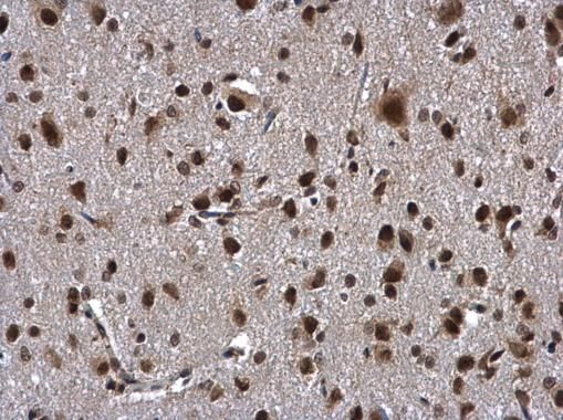 ZNF346 antibody [N1C3]