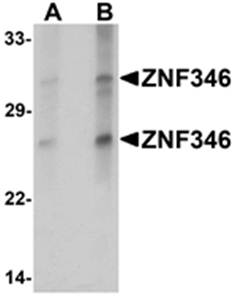 ZNF346 (CT) Antibody