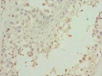 ZNF350 Antibody