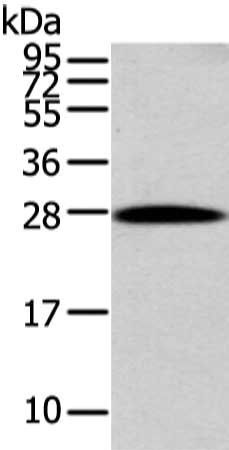 ZNF365 antibody