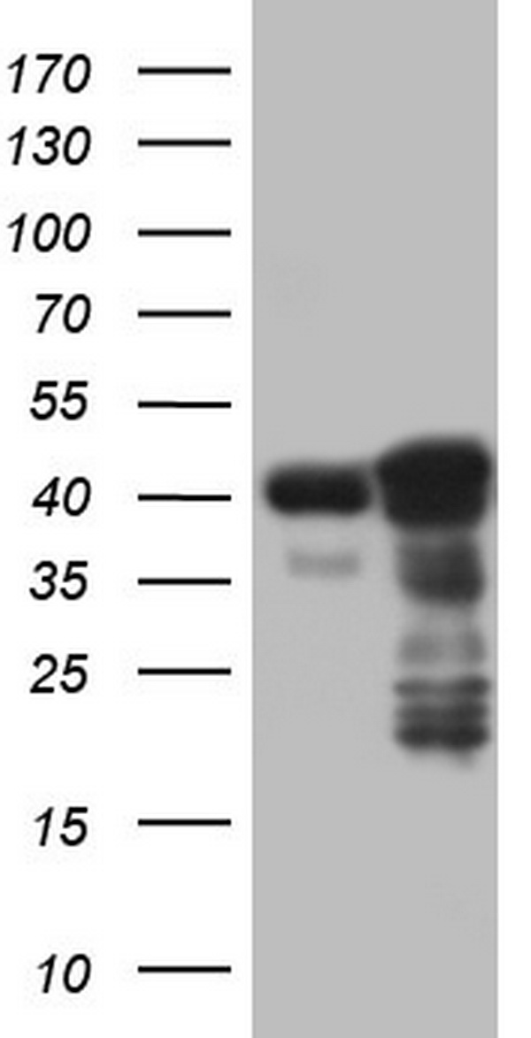 ZNF385B antibody
