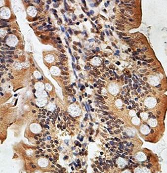 ZNF394 Rabbit Polyclonal Antibody