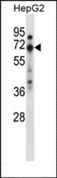 ZNF395 antibody