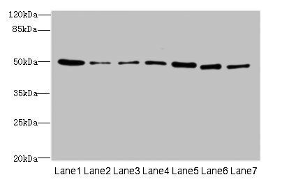 ZNF398 antibody