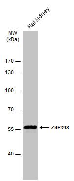 ZNF398 Rabbit Polyclonal Antibody