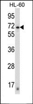 ZNF415 antibody