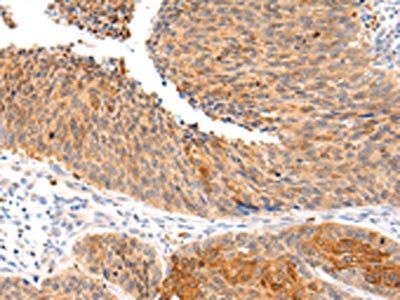 ZNF420 Antibody