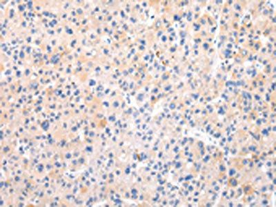 ZNF420 Antibody