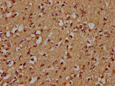 ZNF420 Antibody