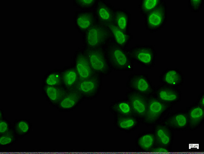 ZNF423 antibody