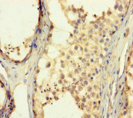 ZNF454 Antibody