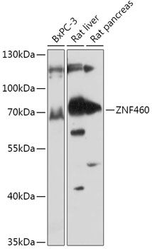 ZNF460 antibody