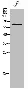 ZNF460 antibody