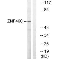 ZNF460 antibody