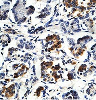 ZNF460 Rabbit Polyclonal Antibody