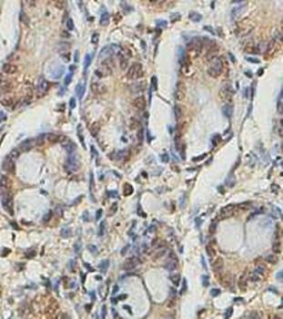 ZNF461 Rabbit Polyclonal Antibody