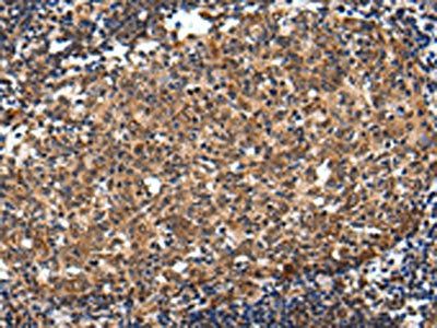 ZNF473 Antibody