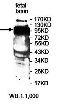 ZNF473 Rabbit Polyclonal Antibody