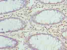 ZNF490 Antibody