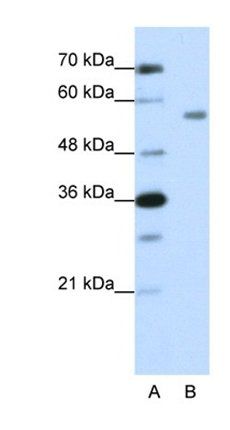 ZNF497 antibody
