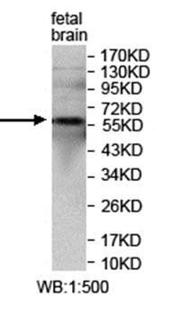 ZNF512 Rabbit Polyclonal Antibody