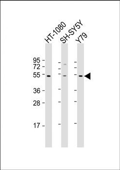ZNF513 antibody