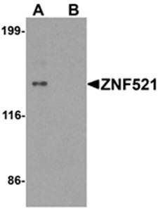 ZNF521 Antibody