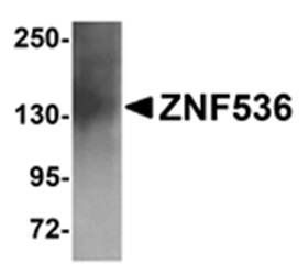ZNF536 Antibody