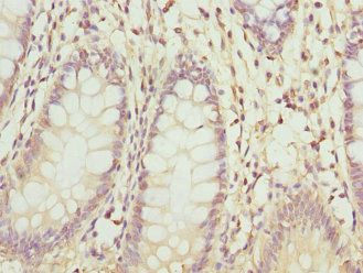 ZNF544 Antibody