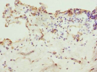 ZNF549 Antibody