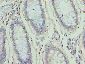 ZNF555 antibody