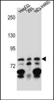 ZNF555 antibody