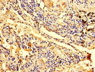 ZNF559 Antibody