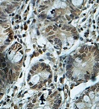 ZNF564 Rabbit Polyclonal Antibody