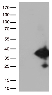ZNF572 antibody