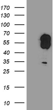 ZNF583 antibody
