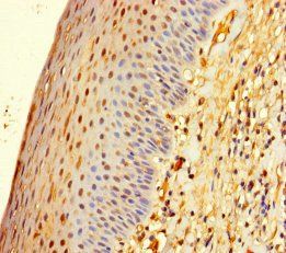 ZNF586 Antibody