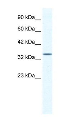 ZNF589 antibody
