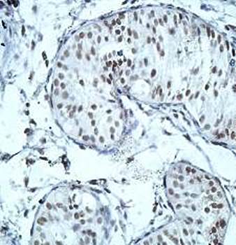 ZNF597 Rabbit Polyclonal Antibody