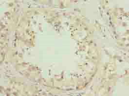 ZNF622 Antibody