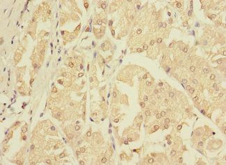 ZNF624 Antibody