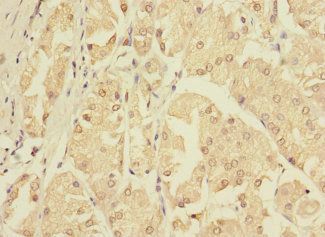 ZNF624 antibody