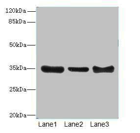 ZNF625 antibody