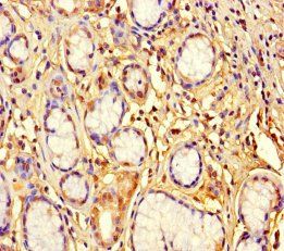 ZNF627 Antibody